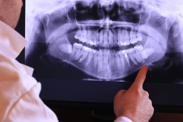 Best Tooth Infection Emergency Dentist  in Northern Cambria, PA